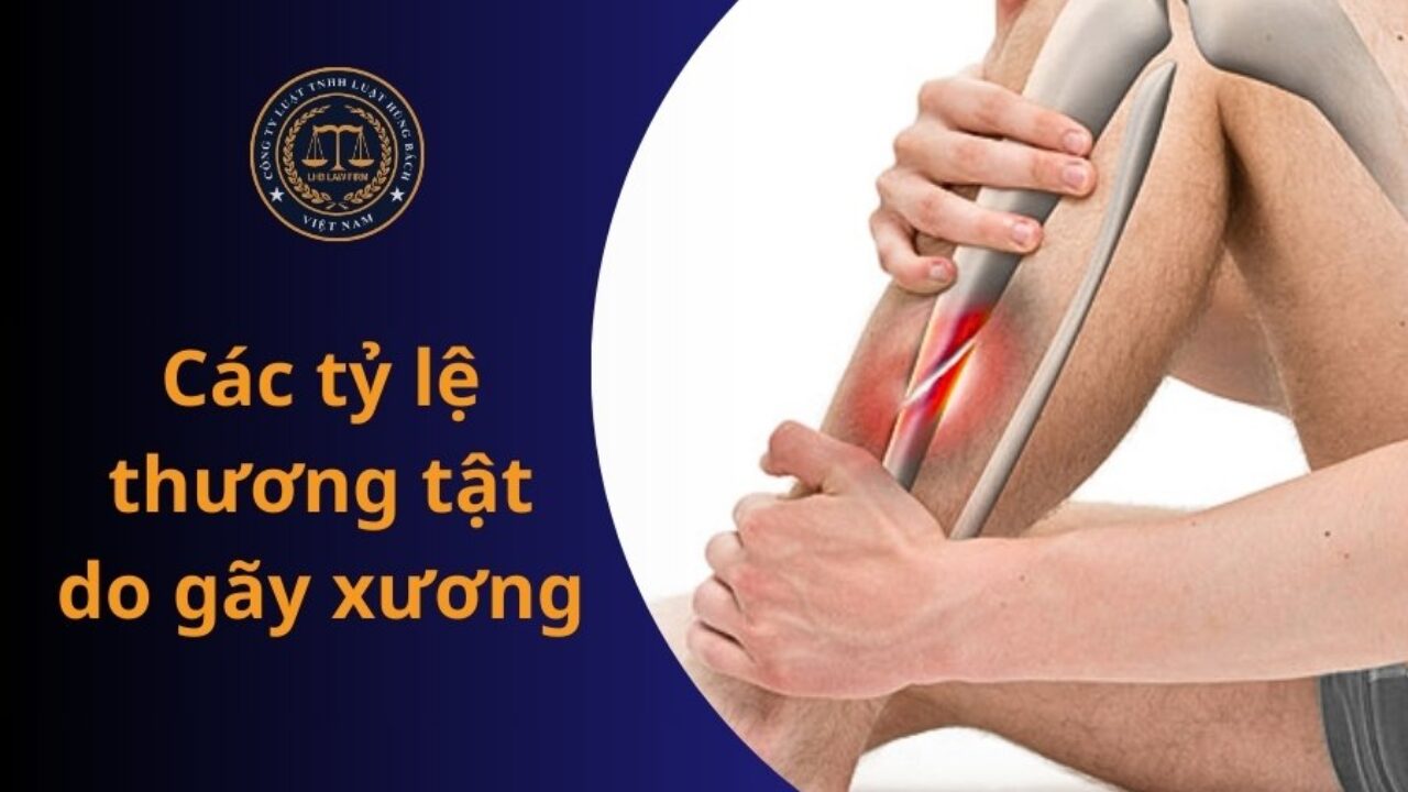 Gãy chân tỷ lệ thương tật bao nhiêu? Cách tính và hướng dẫn chi tiết