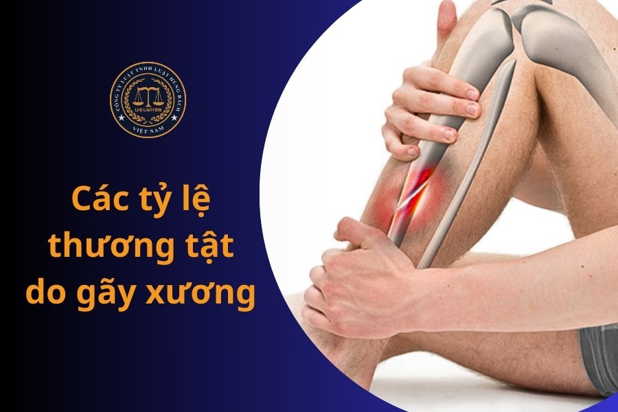 Gãy xương cánh tay tỷ lệ thương tật bao nhiêu? Phân tích và hướng dẫn chi tiết